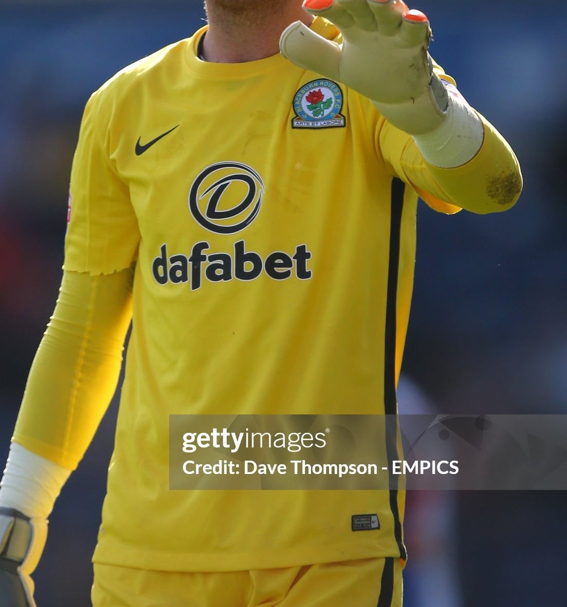 Blackburn Rovers 2015-16 GK 2 Kit